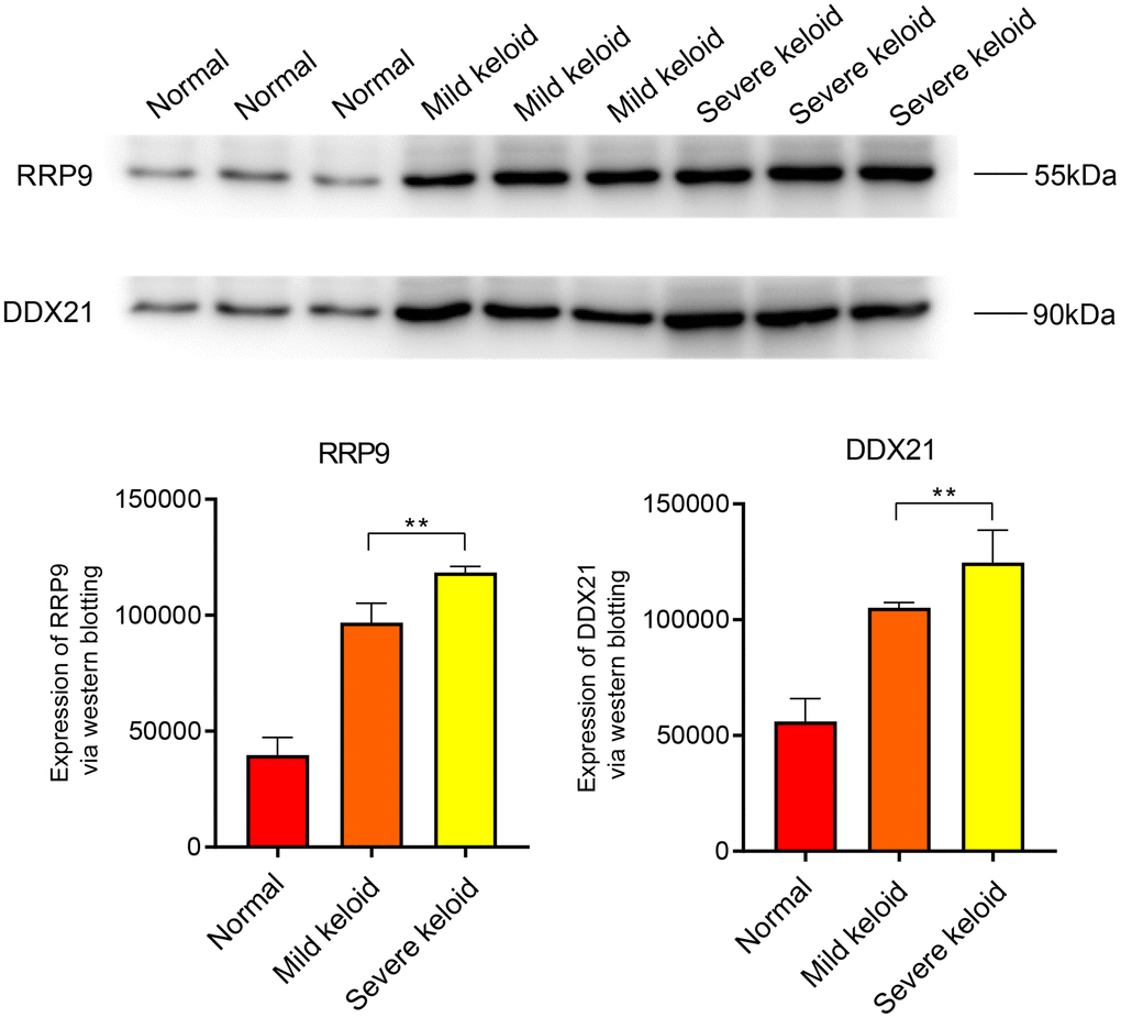 WB experiments. Expression levels of RRP9 and DDX21 in keloid.