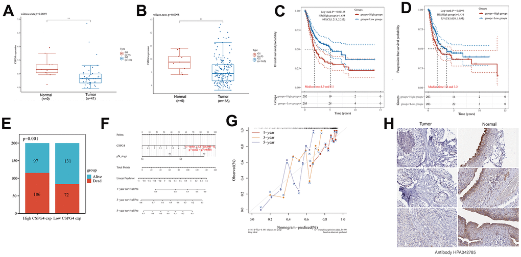 High CSPG4 expression is a BLCA prognostic biomarker. (A, B) CSPG4 expression in BLCA and normal tissues in the GSE3167 and GSE13507 datasets. (C, D) Association of CSPG4 expression with OS and progression-free survival in patients with BLCA. (E) Comparison of death and survival rates between high- and low-CSPG4 expression groups. (F, G) Plotting of nomogram and OS nomogram models based on the results of multivariate Cox regression analysis of CSPG4 expression. (H) Analysis of CSPG4 protein expression in BLCA and normal tissues using the Human Protein Atlas database.