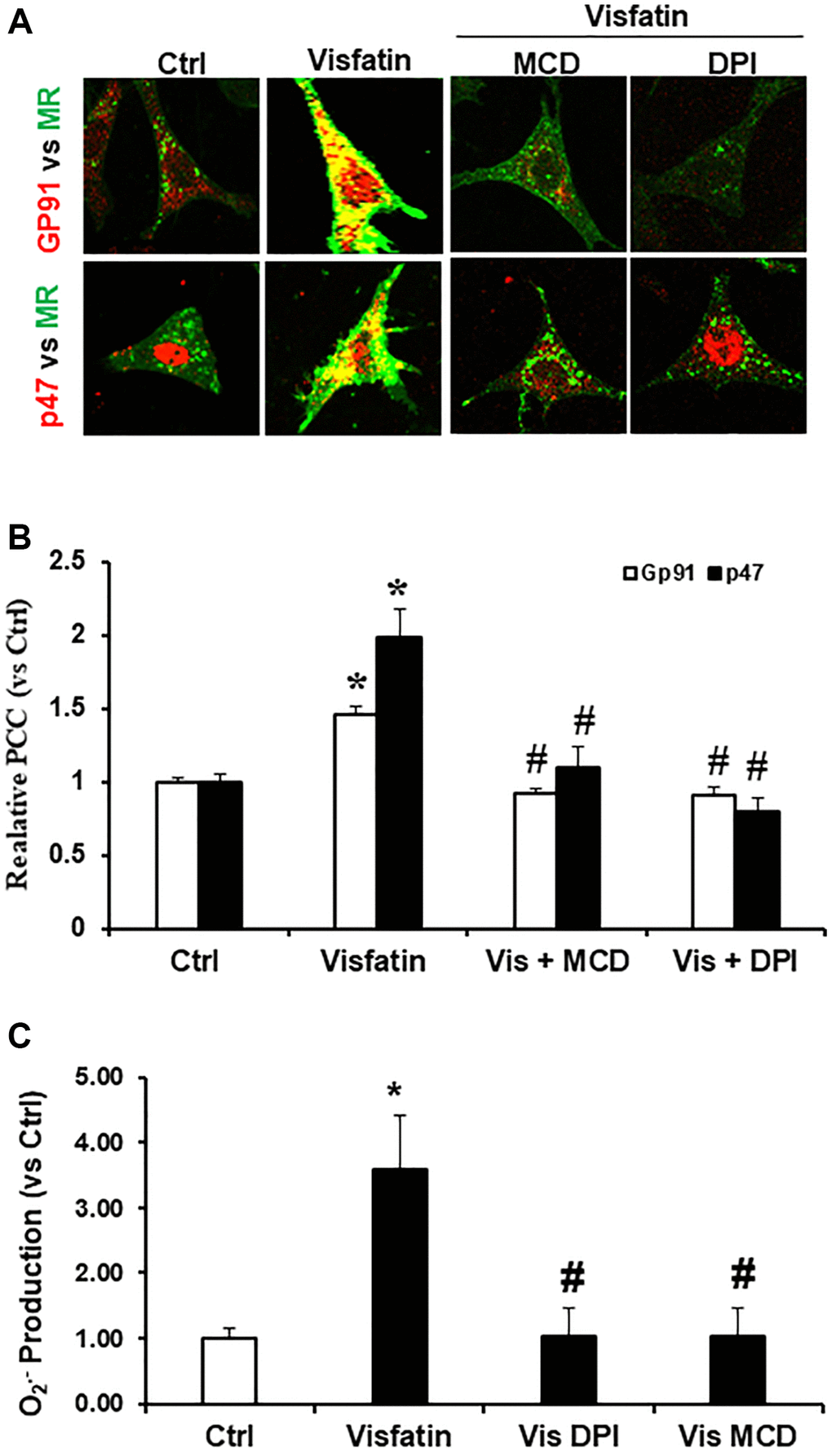 Effects of visfatin on aggregation of gp91phox, p47phox and MR clusters, O2·− production in podocytes. (A) Representative confocal microscopic images of MR clusters (Green) and aggregation of gp91phox (Red) and MR clusters and p47phox (Red) in podocytes (original magnification, 400x). Only overlaid images were presented. Yellow spots in overlaid images indicate co-localization of the MR and gp91phox or p47 phox. (B) Summarized data showing the effects of Visfatin, MR disruptor, MCD and NADPH oxidase inhibitors DPI on MR- gp91phox or MR-p47clusters (n = 6). Values are means ± SEM, showing fold changes as compared with control. (C) Summarized data showing the effects of visfatin on O2·− production (n = 5 − 7). Values are means ± SEM, showing fold changes as compared with control. Abbreviations: Ctrl: Control; Vis: Visfatin; DPI: diphenyleneiodonium; MCD: methyl-β-cyclodextrin. *P #P 