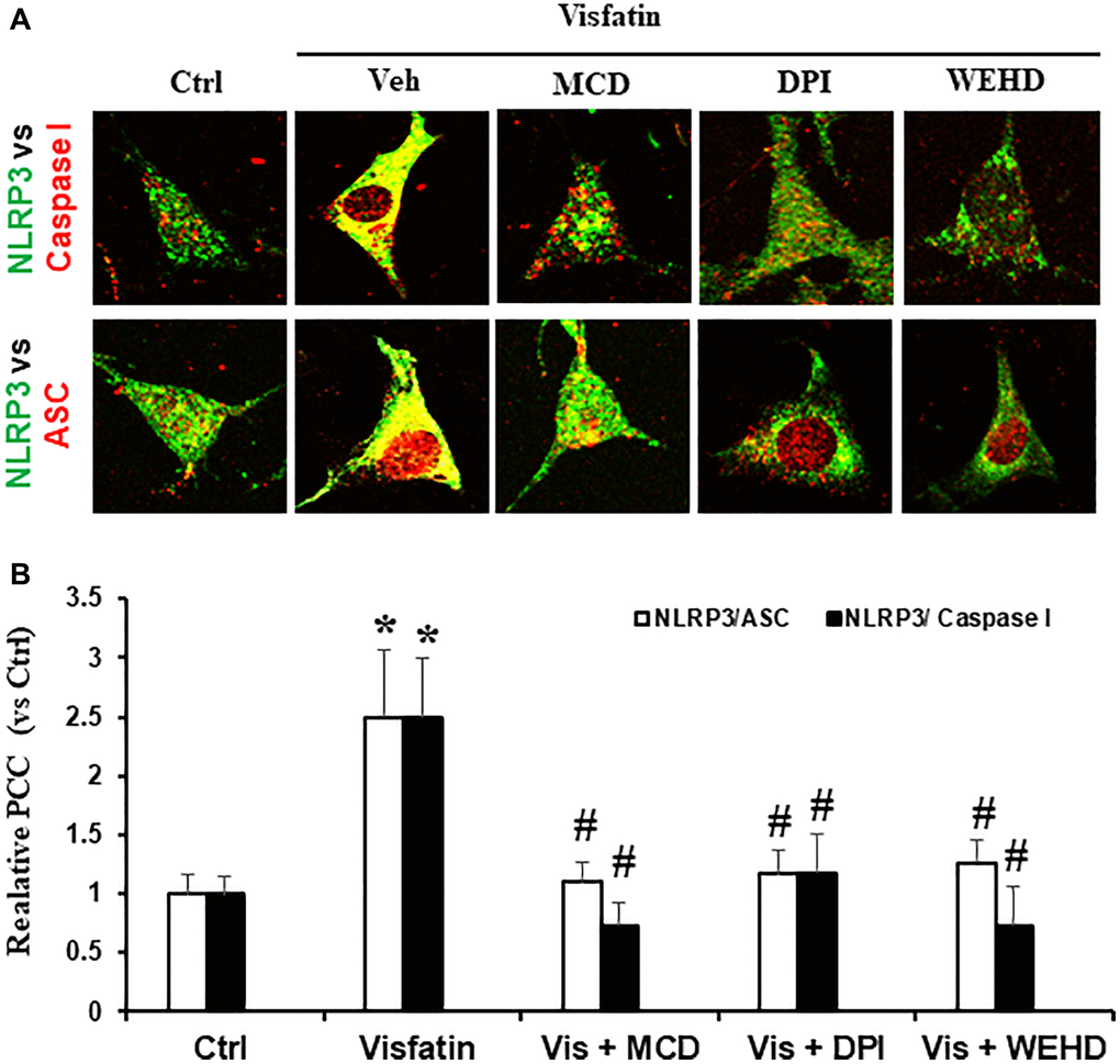 NADPH oxidase inhibition attenuates inflammasome formation induced by visfatin in podocytes. (A) Confocal images representing the colocalization of NLRP3 (green) with ASC (red) and NLRP3 (green) with caspase-1 (red) in podocytes (original magnification, 400x). (B) Summarized data showing the fold change of Pearson correlation coefficient (PCC) for the colocalization of NLRP3 with ASC and NLRP3 with caspase-1 (n = 6). Values are means ± SEM, showing fold changes as compared with control. Abbreviations: Ctrl: Control; Veh: Vehicle; Vis: Visfatin; DPI: diphenyleneiodonium; MCD: methyl-β-cyclodextrin. *P #P 