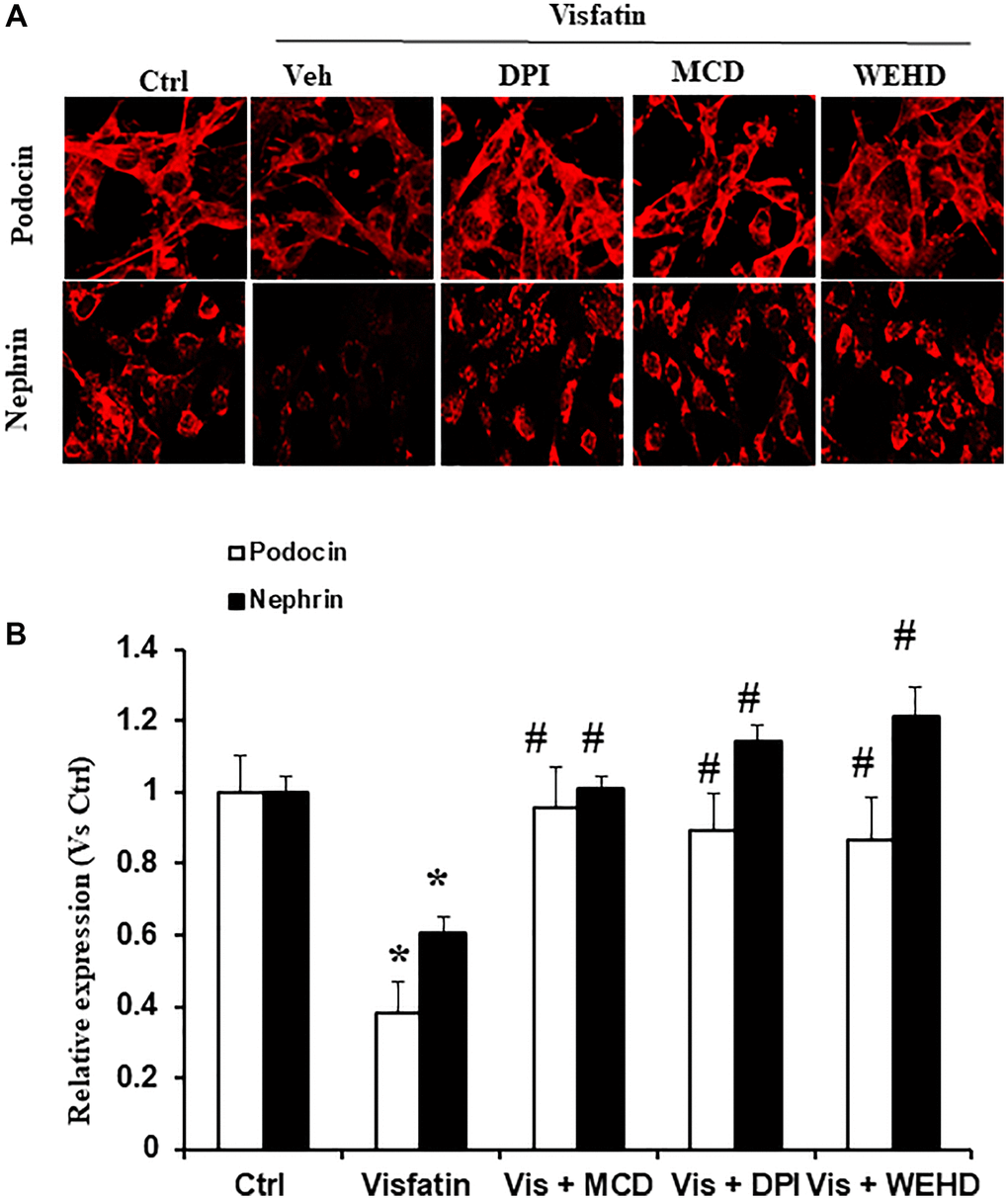 Effects of Visfatin on podocyte injury. (A) Representative immunofluorescence staining of podocin, nephrin, in podocytes with or without stimulation of visfatin, DPI or MCD or WEHD (original magnification, 400x). (B) Summarized data show the percentage of podocyte positive for podocin and nephrin (n = 6). Values are means ± SEM, showing fold changes as compared with control. Abbreviations: Ctrl: Control; Veh: Vehicle; Vis: Visfatin; DPI: diphenyleneiodonium; MCD: methyl-β-cyclodextrin. *P #P 