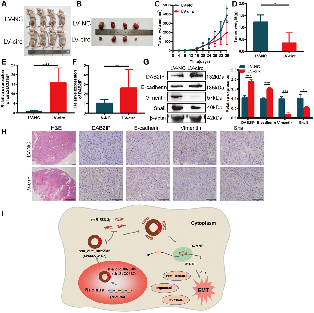 Overexpression of circSLCO1B7 inhibited the growth of HCC cells in vivo. (A, B) Nude mice were injected with LV-control and LV-circ (circSLCO1B7) PLC/PRF/5 cells. After 36 days, the nude mice and tumor tissues were treated and photographed. (C) The size of tumor tissues was measured every 4 days. The growth curve was made after 36 days. (D) The weight of tumor tissues was measured. (E, F) qRT–PCR was used to detect the expression of circSLCO1B7 and DAB2IP in the LV-circ group compared to the LV-control group. (G) Western blot analysis of the protein levels of E-cadherin, Vimentin and Snail in the LV-circ group compared to the LV-control group. (H) HE and IHC experiments showed the difference between the LV-circ group and LV-control group and the expression of DAB2IP, E-cadherin, Vimentin and Snail. (I) A schematic diagram on the mechanism of circSLCO1B7 affecting the progression of HCC. All data are presented as the means ± SD. *P ***P ****P 