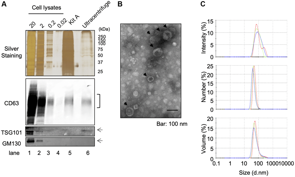 Isolation of EVS from cultured keratinocytes. Conditioned media from human primary keratinocytes were collected. EVs were isolated from these media by an ultracentrifugation protocol. (A) The expression of specific markers for EVs (CD63 and TSG101) were observed in the ultracentrifugation purified EVs fraction (Ultracentrifuge Lane), whereas the expression of GM130 were not observed. 20 μg, 2 μg, 0.2 and 0.02 μg of total cell lysates were also analyzed as well as an EV fraction purified by the Qiagen exoEasy kit (Kit A lane) (B) Analysis of ultracentrifuge purified EVs fraction by transmission electronic microscopy. (C) Hydrodynamic size distribution profiles of ultracentrifuge purified EVs were evaluated by DLS, using either intensity, number or volume quantification. The three color curves correspond to three series of 10 measurements (technical replicates). All experiments were repeated independently at least three times (biological replicates) and a representative result is shown.