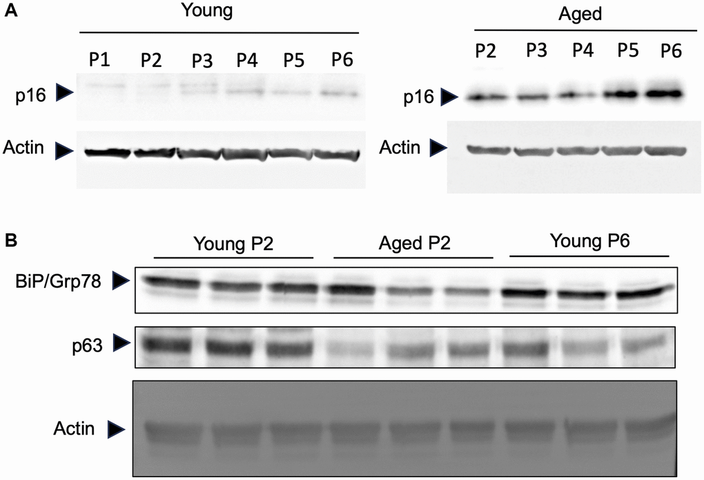 Primary keratinocytes prepared from aged skin represent a valuable model of aging. Primary keratinocytes were isolated from 3 skin biopsies from young (60 years). Cells were cultured from passage 1 (P1) to late passage 6 (P6) and protein were extracted. (A) Western-blot analysis of p16. Actin is used as a loading control. (B) Western-blot analysis of BIP/GRP78 and p63 at passage 2 (P2) and passage 6 (P6). Actin is used as a loading control.