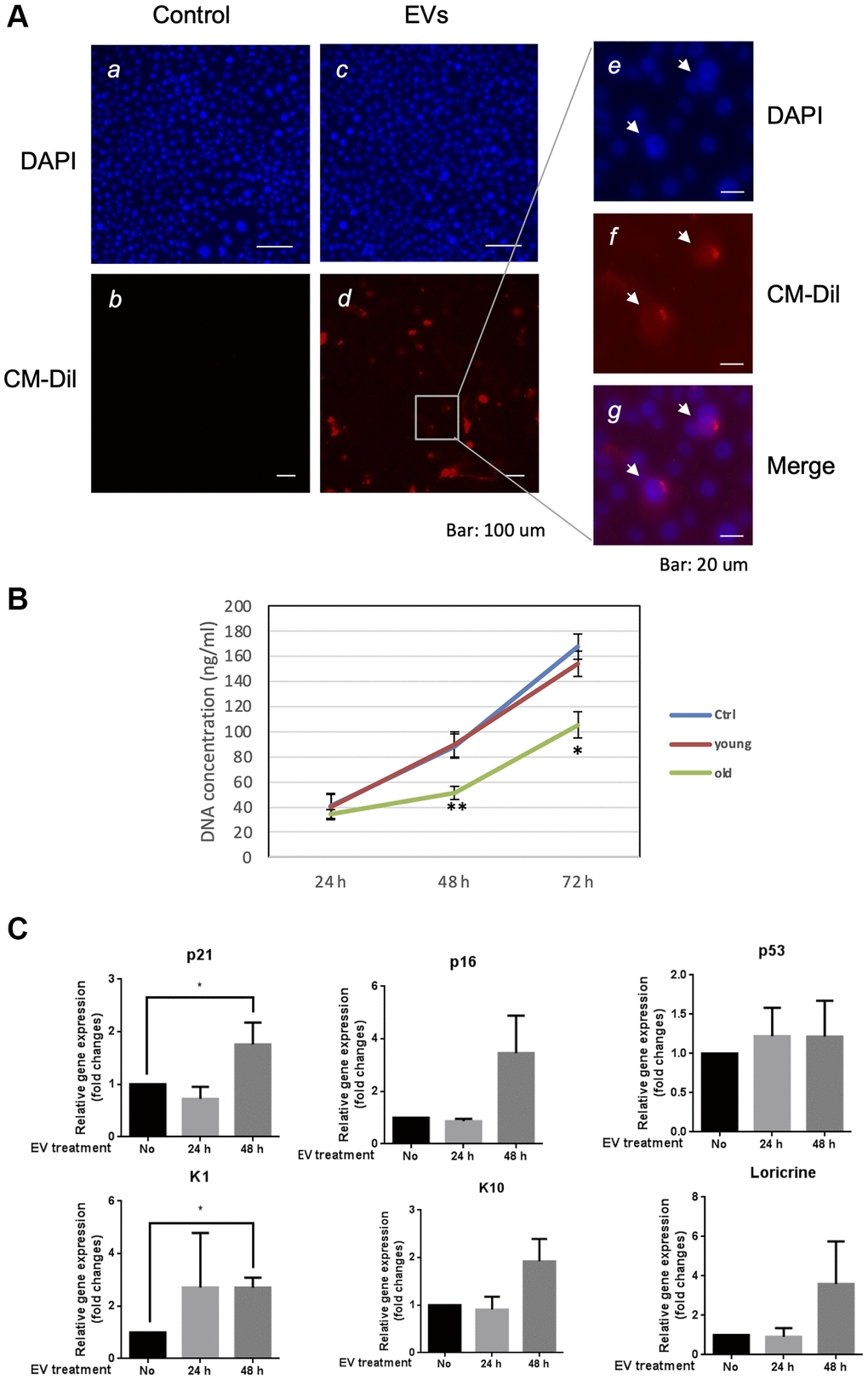 Aged EVs impact proliferation of young keratinocytes in 2D culture. (A) Primary keratinocytes were treated with DAPI only (a, c) or by DAPI plus fluorescently labeled (CM-Dil) EVs from young keratinocytes culture medium (b, d). A part of image d is shown with higher magnification in (e, f, g). (B) Proliferation profile of young cultured keratinocytes treated with EVs purified from young or aged keratinocytes. DNA concentration in treated keratinocytes was measured 24 h, 48 h and 72 h after the beginning of the treatment. (*p-value **p-value n = 3 Student’s t-test). (C) Expression analysis of transcripts for P21, P16, P53, KRT1 (K1), KRT10 (K10) and loricrin in young keratinocytes treated with EVs from old keratinocytes. Data were normalized to the non-treated condition. (*p-value n = 3 Student’s t-test).