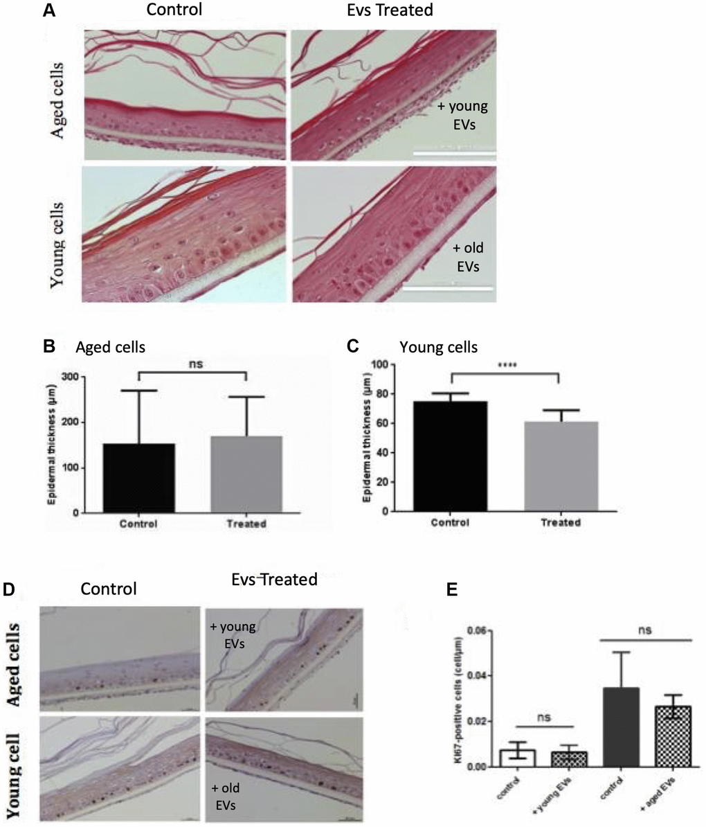 Aged EVs impact epidermal reconstruction in a 3D model. Young or old keratinocytes were used to reconstruct cultured epidermis in a 3D organotypic model. Reconstructed epidermis obtained with aged keratinocytes were treated with EVs obtained from young keratinocytes culture medium. Conversely, reconstructed epidermis obtained with young keratinocytes were treated with EVs obtained from old keratinocytes culture medium. Representative sections stained with hematoxylin/eosin/safranin are shown in (A) (Scale bar = 100 μm). The epidermal thickness in 3D culture corresponding to old keratinocytes treated with young EVs are shown in (B) (Abbreviation: ns: non-significant in Student t-test). The epidermal thickness in 3D culture corresponding to young keratinocytes treated with old EVs are shown in (C) (***p-value t-test). The reconstructed epidermis sections were stained with Ki67. Representative images of the various conditions are shown in (D) The number of Ki-67 positive cells per μm is shown in (E) The 2 first bars in left correspond to 3D cultures from aged cells whereas the bars in right correspond to 3D cultures with young cells (Abbreviation: ns: non-significant in a Student t-test).