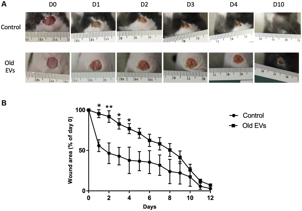 Aged EVs impact the early phases of wound healing in mice. Wound closure assay on mice treated with EVs from old keratinocytes. (A) Representative photographs of full-thickness excisional wounds treated at day 0 (D0) with NaCl (Control n = 4) or with EVs from old human keratinocytes (n = 8) every day from day 0 to day 10 (D10). (B) Quantitative analysis of wound healing closure in each group, expressed as a percentage of the initial wound area (*p-value **p-value t-test).