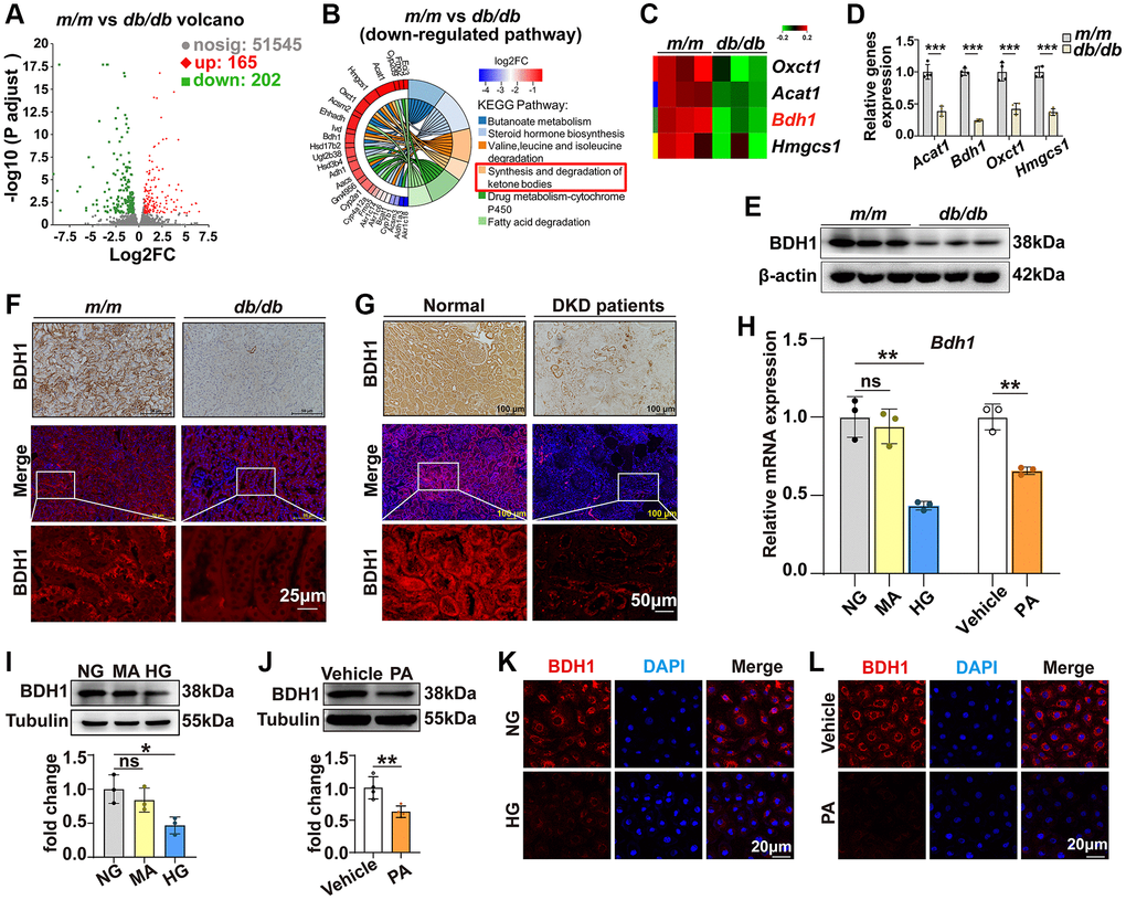 Expression of BDH1 is downregulated in diabetic kidney and HG- or PA-treated HK-2 cells. (A) Volcano plot showing differentially expressed genes (DEGs) (red, upregulated genes; green, downregulated genes) in the kidneys of m/m and db/db mice (n = 3 mice per group). (B) KEGG enrichment analysis showing the top 6 downregulated pathways. (C) Four DEGs involved in ketone body synthesis and degradation pathways. (D) qRT-PCR analysis showing the mRNA levels of Acat1, Bdh1, Oxct1, and Hmgcs1 in the kidneys of m/m and db/db mice (n = 3 mice per group). WB (E), IHC, and IF (F) showing the protein level of BDH1 in the kidneys of m/m and db/db mice. IHC and IF (G) showing the protein level of BDH1 in the kidneys of normal subjects (n = 9) and patients with DKD (n = 8). (H) qRT-PCR showing the mRNA level of Bdh1 in HK-2 cells treated with HG or PA. Representative WB images showing the protein level of BDH1 in HK-2 cells stimulated with HG (I) or PA (J). Representative IF images showing the protein level of BDH1 in HK-2 cells stimulated with HG (K) or PA (L). All results are representative of three independent experiments. Values are presented as mean ± standard deviation. Bar: 50 and 25 μm in F, and 100 and 50 μm in G, 20 μm in K and L. Abbreviations: BDH1: β-hydroxybutyrate dehydrogenase 1; NG: normal glucose; HG: high glucose; PA: palmitic acid; MA: mannitol; DEGs: differentially expressed genes; WB: western blot; IHC: immunohistochemistry; IF: immunofluorescence; DKD: diabetic kidney disease. *P **P ***P 