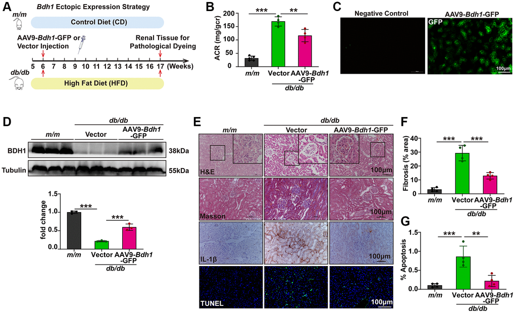 AAV9-mediated BDH1 ectopic expression in kidneys alleviates the progression of DKD. (A) Schematic diagram illustrating the animal experimental design. During the experiment, m/m mice were fed a control diet (CD), while db/db mice were fed an HFD. Six-week-old male db/db mice were randomized to receive tail vein injection of AAV9-Bdh1-GFP (3.40E+12 vg/mL) or vector (1.90E+13 vg/mL). Mice were euthanized at 11 weeks after AAV9 injection. (B) Urinary ACR values of mice in the indicated groups (n = 5 in m/m group, n = 4 in vector, and AAV-Bdh1-GFP injected db/db group). (C) Representative renal fluorescent images of the mice 11 weeks after caudal vein delivery of AAV-Bdh1-GFP revealing GFP expression in the kidneys. (D) Representative WB image showing the protein level of BDH1 in the kidneys of indicated groups. (E) Representative photomicrographs of H&E, Masson, IHC (IL-1β), and TUNEL staining showing the pathological changes in the kidneys of indicated groups. (F) Quantification of the fibrosis area in the kidneys of indicated groups (n = 4 per group). (G) Quantification of apoptosis-positive cells in the kidneys of indicated groups (n = 4 per group). All results are representative of three independent experiments. Values are presented as mean ± standard deviation. Bar: 100 μm in C and E. Abbreviations: CD: control diet; HFD: high fat diet; ACR: albumin-to-creatinine ratio; AAV9: adeno-associated virus 9; BDH1: β-hydroxybutyrate dehydrogenase 1; DKD: diabetic kidney disease; WB: western blot; H&E: hematoxylin and eosin; IHC: immunohistochemistry. *P **P ***P 