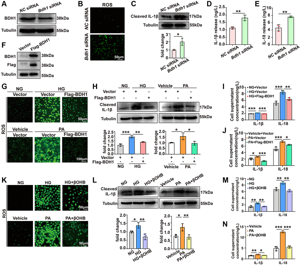 BDH1-mediated βOHB metabolism reverses HG or PA-induced ROS overproduction and inflammation. (A) Representative WB image showing the protein level of BDH1 in HK-2 cells transfected with NC siRNA or Bdh1 siRNA. (B) DCFH-DA probe was used to identify the level of ROS in HK-2 cells transfected with NC siRNA or Bdh1 siRNA. (C) Representative WB image showing the protein level of IL-1β in HK-2 cells transfected with NC siRNA or Bdh1 siRNA. (D, E) ELISA showing the levels of IL-1β (D) and IL-18 (E) in the cell culture supernatant of HK-2 cells transfected with NC siRNA or Bdh1 siRNA. (F) Representative WB image showing the protein level of BDH1 in HK-2 cells transfected with vector or Flag-BDH1. (G) DCFH-DA probe was used to identify the level of ROS in HK-2 cells based on the indicated treatment. (H) Representative WB image showing the protein level of IL-1β in HK-2 cells based on the indicated treatment. (I, J) ELISA showing the levels of IL-1β and IL-18 in the cell culture supernatant of BDH1-overexpressed HK-2 cells treated with HG (I) or PA (J). For samples used in G-J, HK-2 cells were transfected with the plasmids overexpressing Flag-BDH1 or vector for 6 h and then treated with HG or PA for 48 h. (K) DCFH-DA probe was used to identify ROS levels in HK-2 cells based on the indicated treatment. (L) Representative WB image showing the protein level of IL-1β in HK-2 cells based on the indicated treatment. (M, N) ELISA showing the levels of IL-1β and IL-18 in the cell culture supernatant of βOHB-supplemented HK-2 cells treated with HG (M) or PA (N). For samples used in K-N, HK-2 cells were treated with vehicle or βOHB and HG or PA for 48 h. All results are representative of three independent experiments. Values are presented as mean ± standard deviation. Bar: 50 μm in B, 50 μm in top panels and 100 μm in bottom panels in G, 50 μm in K. Abbreviations: BDH1: β-hydroxybutyrate dehydrogenase 1; βOHB: β-hydroxybutyrate; HG: high glucose; PA: palmitic acid; ROS: reactive oxygen species; WB: western blot. *P **P ***P 