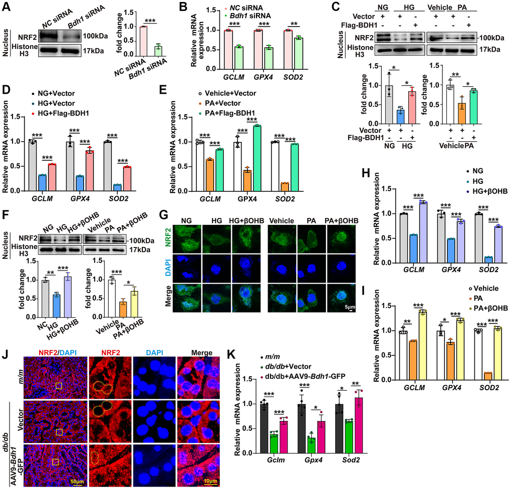 BDH1-mediated βOHB metabolism promotes NRF2 nuclear translocation. (A) Representative WB image showing the protein level of NRF2 protein in the nuclear translocation of HK-2 cells transfected with NC siRNA or Bdh1 siRNA. (B) mRNA expression of GCLM, GPX4, and SOD2 in HK-2 cells transfected with NC siRNA or Bdh1 siRNA. (C) Representative WB images showing the protein level of NRF2 in the nuclear translocation of BDH1-overexpressed HK-2 cells treated with HG or PA. (D, E) mRNA expression of GCLM, GPX4, and SOD2 in BDH1-overexpressed HK-2 cells stimulated with HG (D) or PA (E). (F) Representative WB images showing the protein level of NRF2 in the nuclear translocation of βOHB-supplemented HK-2 cells treated with HG or PA. (G) Representative IF images showing the location of NRF2 in βOHB-supplemented HK-2 cells treated with HG or PA. (H, I) The mRNA expression of GCLM, GPX4, and SOD2 in βOHB-supplemented HK-2 cells stimulated with HG (H) or PA (I). (J) Representative IF images showing the location of NRF2 in kidneys of indicated groups. (K) mRNA levels of Gclm, Gpx4, and Sod2 in the kidneys of m/m group (n = 5), db/db + Vector (n = 4), and db/db + AAV-Bdh1-GFP group (n = 4). All results are representative of three independent experiments. Values are presented as mean ± standard deviation. Bar: 5 μm in G, 50 μm and 10 μm in J. Abbreviations: BDH1: β-hydroxybutyrate dehydrogenase 1; βOHB: β-hydroxybutyrate; WB: western blot; HG: high glucose; PA: palmitic acid; IF: immunofluorescence. *P **P ***P 