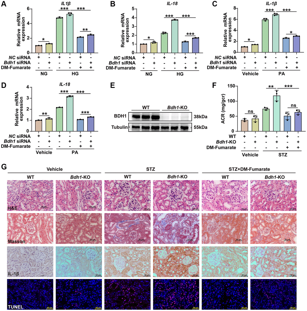 DM-Fumarate treatment reverses the Bdh1 deficiency-induced increase of renal inflammation and pathological injury. (A–D) qRT-PCR analysis showing the IL-1β and IL-18 mRNA levels of indicated groups (5 μM DM-Fumarate for 48 h). (E) Representative WB image showing the protein level of BDH1 in the kidneys of WT and Bdh1-KO mice. (F) Urinary ACR values of mice in indicated groups (n = 3 in per group). (G) Representative photomicrographs of H&E, Masson, IHC (IL-1β), and TUNEL staining showing the pathological changes in the kidneys of indicated groups. All results are representative of three independent experiments. Values are presented as mean ± standard deviation. Bar: 50 μm in G. Abbreviations: ACR: albumin-to-creatinine ratio; Bdh1: β-hydroxybutyrate dehydrogenase 1; DKD: diabetic kidney disease; WB: western blot; H&E: hematoxylin and eosin; IHC: immunohistochemistry; STZ: streptozotocin; DM-Fumarate: dimethyl fumarate. *P **P ***P 