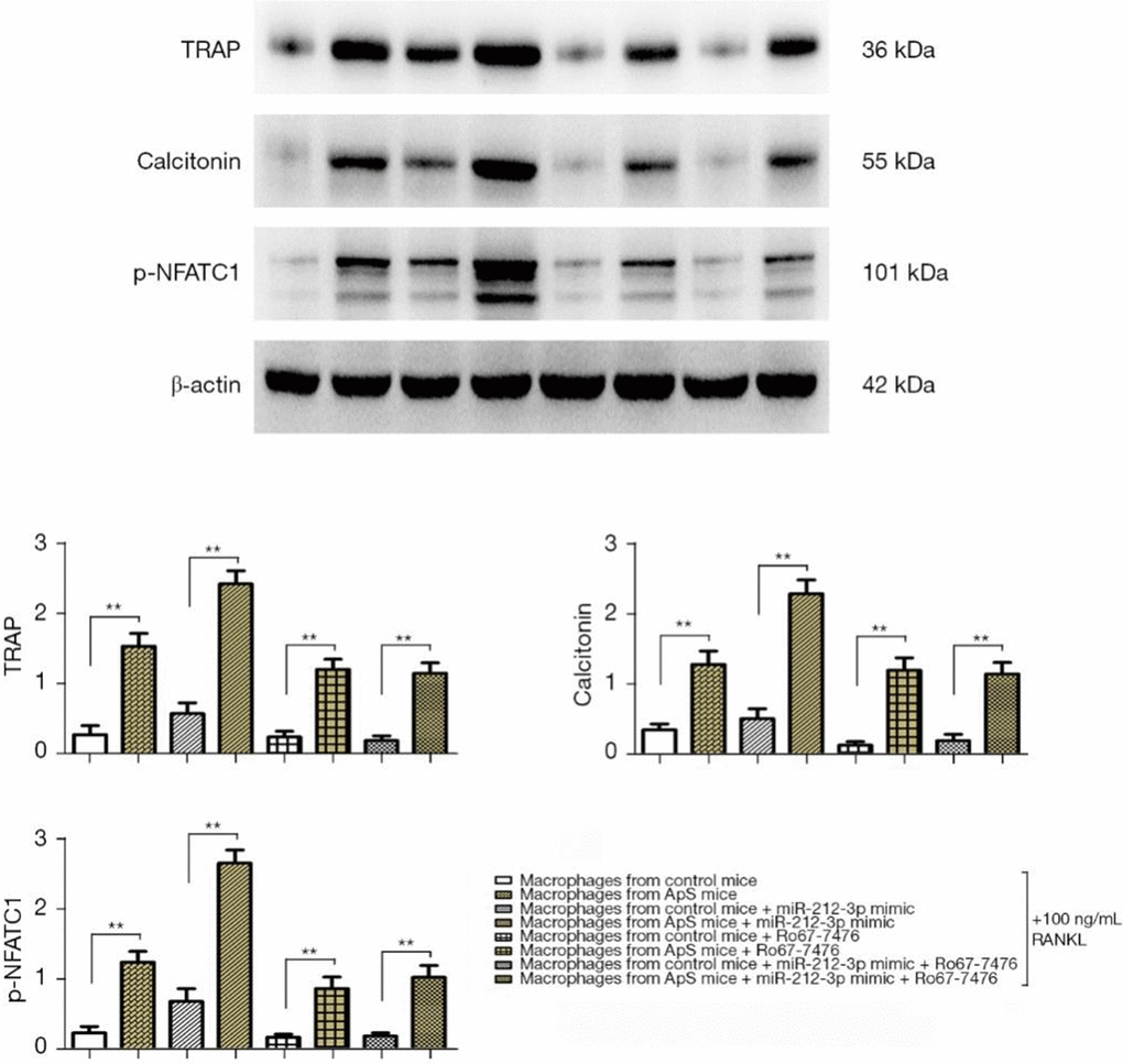 The directed differentiation of monocyte-macrophages into OCs was induced by 100 ng/mL RANKL added to the medium in each group, and the protein expressions of TRAP, calcitonin, and p-NFATC1 in monocyte-macrophages were measured by Western blotting. OCs, osteoclasts; RANKL, receptor activator of nuclear factor-κB ligand; TRAP, tartrate-resistant acid phosphatase; NFATC1, nuclear factor of activated T cell 1.