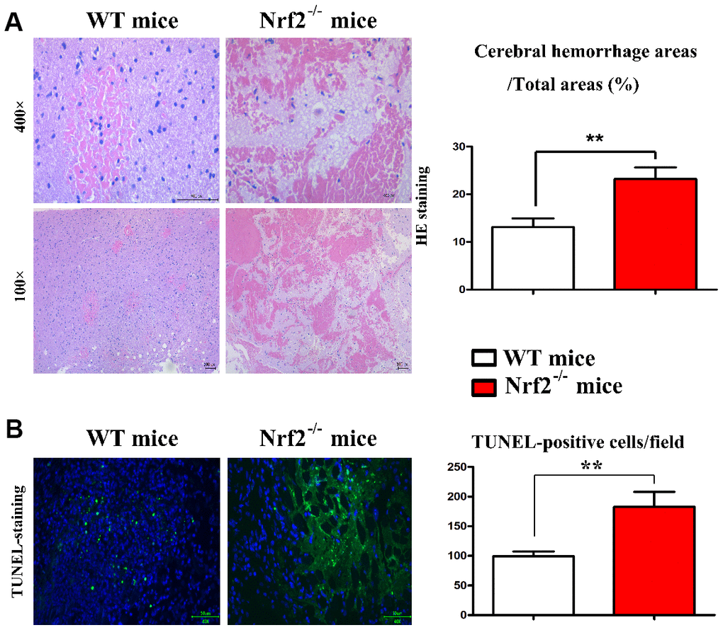 Histomorphological observation for the brain tissue and TUNEL assay. (A) Histomorphological observation for the brain tissue. (B) Effect of Nrf2 on apoptosis of nerve cells in brain injury induced by hydraulic shock.