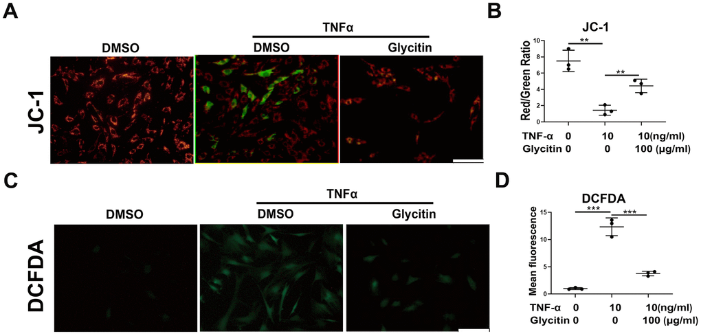 Glycitin alleviated TNF-α-induced oxidative stress and mitochondrial dysfunction in HNPCs. (A, B) JC-1 assay was applied to detect the mitochondrial membrane potential of human NP cells in every group (n=3). Scale bar: 100μm. (C, D) ROS levels of human NP cells were detected with DCFDA (n=3). Scale bar: 100 μm. The values shown represent the mean ± SD of three independent experiments. *p 