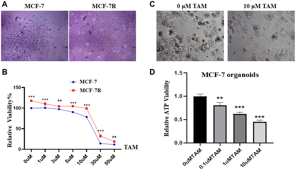 Establishment and identification of tamoxifen-resistant cells and MCF-7-like organs. (A) The morphology of the MCF-7R-resistant cell line is rounded and nearly spherical, whereas the MCF-7 parental cells are nearly spindle-shaped. (B) Proliferation rates of MCF-7 and MCF-7R cells after treatment with different concentration gradients of tamoxifen for 48 hours. (C) Growth of MCF-7-like organs in different concentrations of tamoxifen: intact growth at 0 μM, lysis and death at 10 μM. (D) ATP energy.