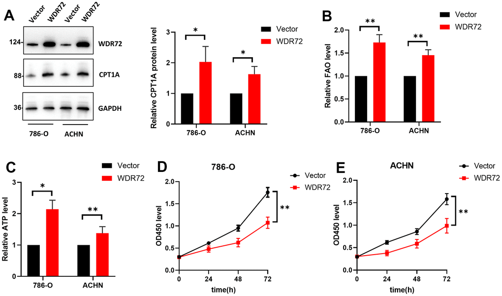 Effects of WDR72 gene expression on fatty acid beta-oxidation and proliferation of ccRCC cells. (A) Western blot analysis showed the protein expression of WDR72 and CPT1A (the critical enzyme of FAO after WDR72 overexpression in 786-O and ACHN cells. (B, C) FAO and ATP level FAO after WDR72 overexpression in 786-O and ACHN cells. (D, E) CCK8 showed the proliferative capacity of 786-O and ACHN cells after WDR72 overexpression. Abbreviations: WDR72, WD repeat-containing protein 72; FAO, fatty acid oxidation; CPT1A, carnitine palmitoyltransferase 1A; ATP, adenosine triphosphate; OD, optical density; * P 