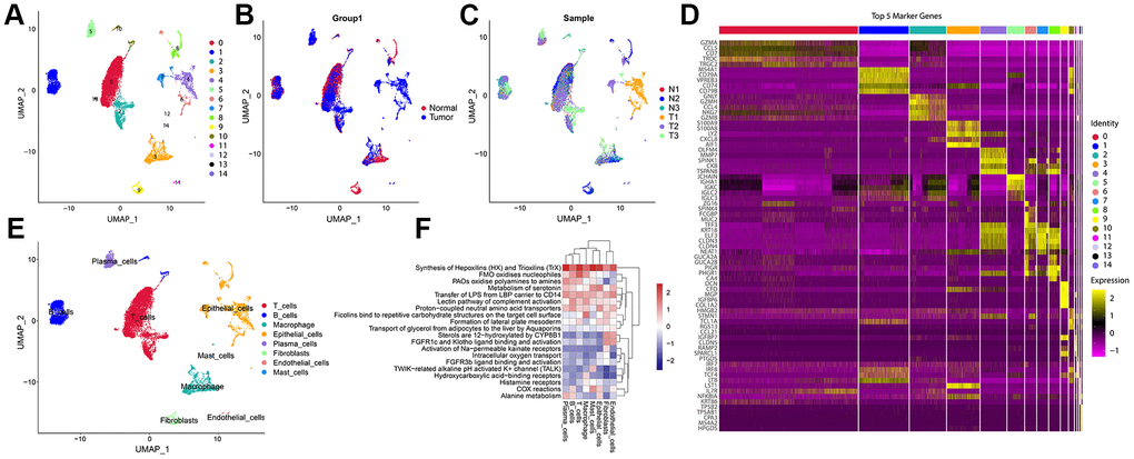 A Single-cell atlas of CRC. (A) UMAP representation of scRNA-seq from CRC cells reveals 15 distinct clusters. (B) UMAP dimensional reduction visualizations single cells from tumour tissues and normal control tissues. (C) UMAP dimensional reduction visualizations single cells from six types of samples. (D) The heatmap showed the relative expression of genes in 15 clusters. The color yellow represents genes that are highly expressed, and the color purple represents genes that are lowly expressed. (E) Eight major cell types identified in CRC. (F) Pathway gene set enrichment analysis of the expression profiles for each cell-type.