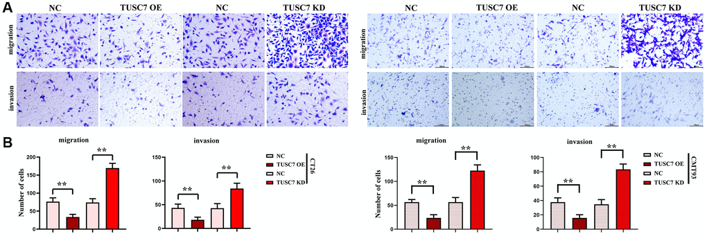 Migration and invasion of CT26 cells detected by Transwell assay. (A) Results of migration and invasion assays. (B) Data statistics of migration and invasion assays. **p 