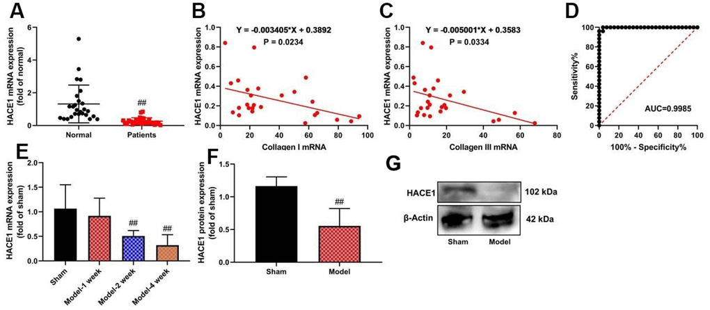 The expression levels of HACE1 in patients with heart failure. HACE1 mRNA expression (A), HACE1 related to collagen I or collagen III (B, C), ROC curve (D) in patients with Heart failure; HACE1 mRNA and promoted expression-rtPCR (E, F) and wester blot (G) in mice model of Heart failure. ##p