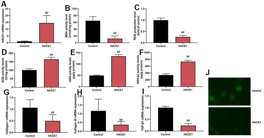 HACE1 reduced oxidative stress in vitro model. HACE1 mRNA expression (A), MDA, ROS, SOD, GSH and GSH-px levels (B–F), collagen I, collagen III and TGF-β mRNA expression (G–I). ##pJ).