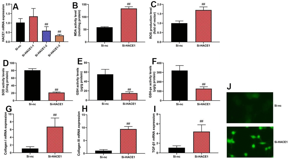 The inhibition of HACE1 promoted oxidative stress in vitro model. HACE1 mRNA expression (A), MDA, ROS, SOD, GSH and GSH-px levels (B–F), collagen I, collagen III and TGF-β mRNA expression (G–I). ##pJ).