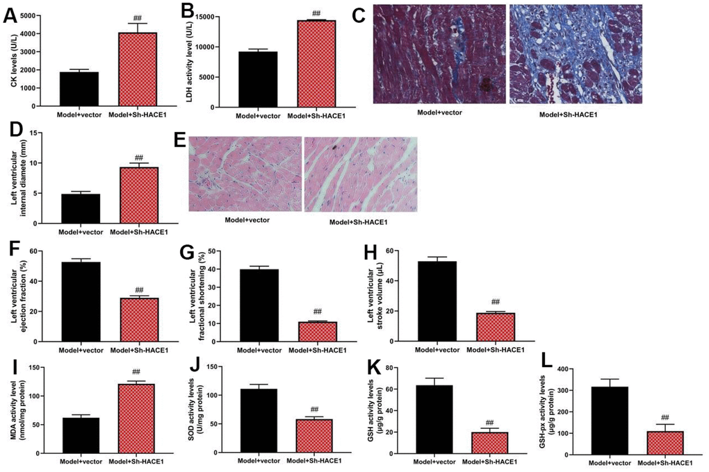 Sh-HACE1 could promote heart failure in mice model. CK and LDH activity levels (A, B), heat tissue injury (Masson and HE staining, C), left ventricular internal diameter (D), heat tissue injury (Masson and HE staining (E), left ventricular ejection fraction (F), left ventricular fractional shortening (G), left ventricular stroke volume (H), MDA/SOD/ GSH/GSH-PX levels in heat tissue (I–L) ##p