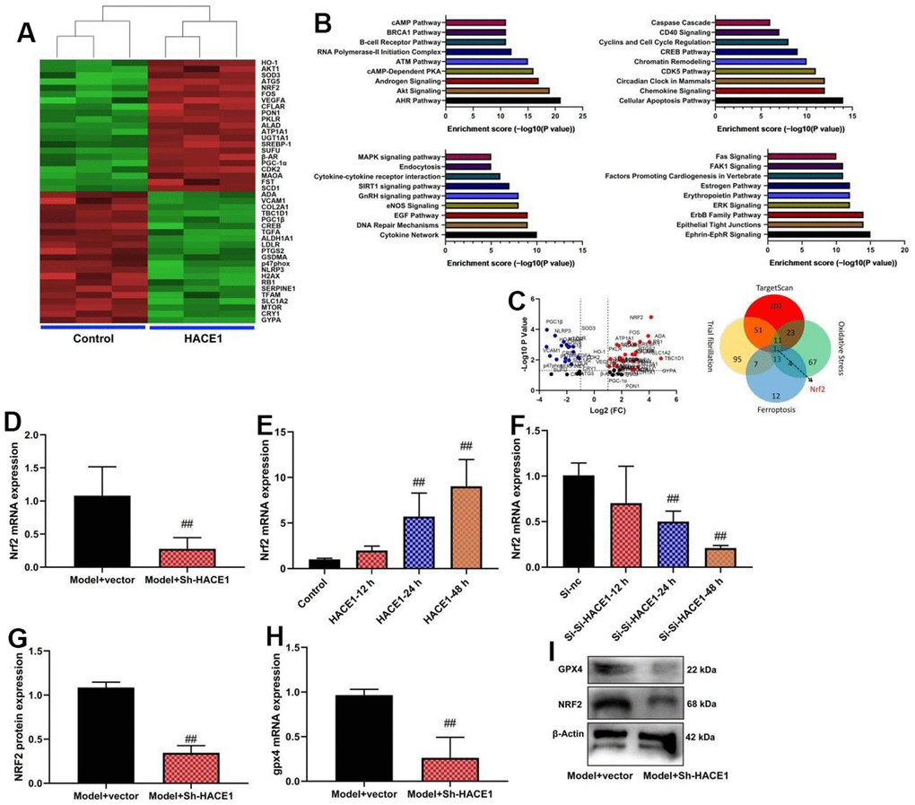 NRF2 is one target for HACE1 in model of heart failure. Microarray analysis (A–C), NRF2 mRNA expression (D–F), NRF2 and GPX4 protein expressions (G, H) GPX4 protein expressions in blot (I). ##p