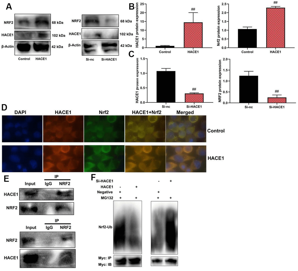 HACE1 promoted NRF2 activity levels by its Ubiquitination in model of heart failure. NRF2 protein expression (A–C), HACE1 and NRF2 expression (Microscopic display, (D), ACE1 protein connected with NRF2 protein (IP, E), NRF2 Ubiquitination (F). ##p