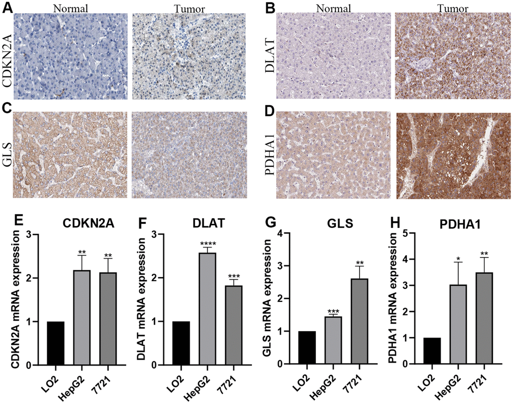 Verification of the mRNA and protein expression. (A–D) Images from the Human Protein Atlas show the protein expression of 4 prognostic CRGs in HCC and corresponding normal tissues. (E–H) qRT-PCR analysis detected the mRNA expression 4 prognostic CRGs in normal cell line (Lo2), and HCC cell lines (7721, HepG2). *P P P 