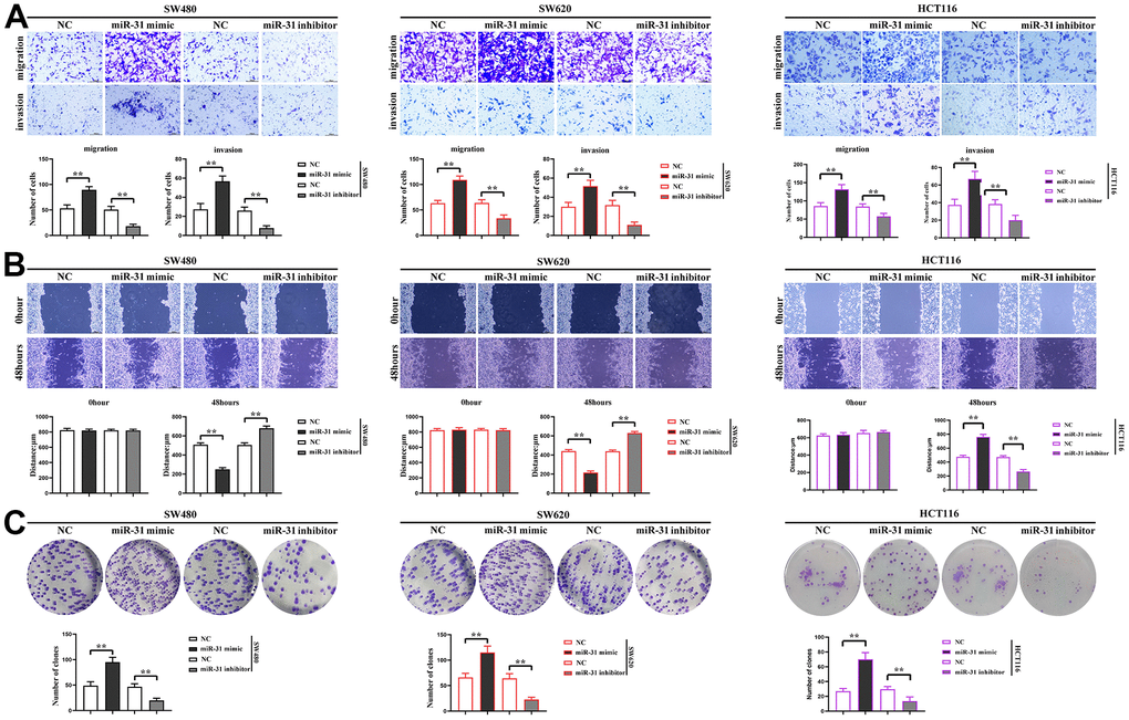 miR-31 promotes the proliferation, migration and invasion of CRC cells. (A) Transwell measured the migration and invasion capacity of individual groups of cells; (B) Cell scratch assays determined the migration capacity of cells in each group; (C) Monoclonal proliferation assays detected the proliferation capacity of each group of cells. **P