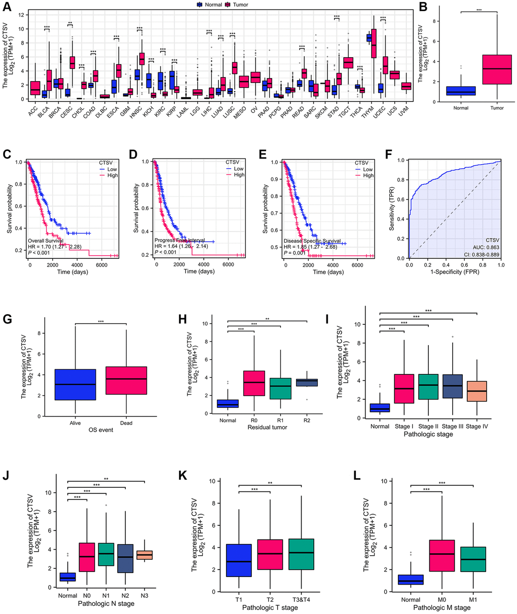Identification of CTSV as the driver for malignant progression of lung cancer. (A) CTSV expression analysis in pan-cancer using tumor tissues paired with normal tissues from the TCGA database. (B) CTSV expression analysis of lung cancer using lung cancer and normal samples from the TCGA database. (C–E) Kaplan-Meier survival curves based on CTSV expression in the lung cancer samples. (F) ROC analysis of lung cancer based on CTSV expression. (G, H) The expression of CTSV was analyzed based on OS events and residual tumor. (I–L) Relationship between CTSV expression and clinical outcomes including (I) Pathologic stage, (J) N stage, (K) T stage, (L) M stage. *P **P ***P 