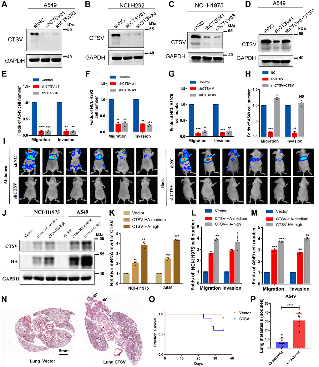 CTSV contributes to the metastasis of lung cancer cells both in vitro and in vivo. (A–C) A549, NCI-H292, and NCI-H1975, lung cancer cells transfected with the indicated negative control plasmids, shCTSV#1 or shCTSV#3, for 48 h were analyzed by Western blotting. The results were repeated for three biologically independent experiments. (D) The indicated stable cells transfected with shCTSV#1 and HA-CTSV for 48 h were subjected to Western blotting. The grouping of blots cropped from different parts of the same gel. (E–H) The indicated stable cells were analyzed by cell migration and invasion assays. The results are the mean ± SD of three biologically independent experiments. *P **P ***P t-test. NS represents no significance. (I) Bioluminescent imaging analysis of mice. Representative images are shown (n = 6 mice per group). The tumors were isolated at the end of the experiments. (J–M) CTSV-HA-medium or CTSV-HA-high NCI-H1975 and A549 cells were transiently transfected with sgRNAs as indicated and then analyzed by Western blotting, qRT-PCR, cell migration, and invasion assays. The results showed that with the increase in CTSV expression (2–5 times the normal value), the promoting effect of CTSV on migration and invasion also improved. The grouping of blots cropped from different parts of the same gel. (N–P) H&E staining of lungs from representative tumor-bearing nude mice. Scale bars, 5 mm. Kaplan-Meier survival curves of the nude mice in the vector and CTSV-HA groups. Quantification of lung nodules. Data are shown as the mean ± SD and P-values; two-tailed Student’s t-tests were used to analyze the data. ****P-value Supplementary Figure 1.