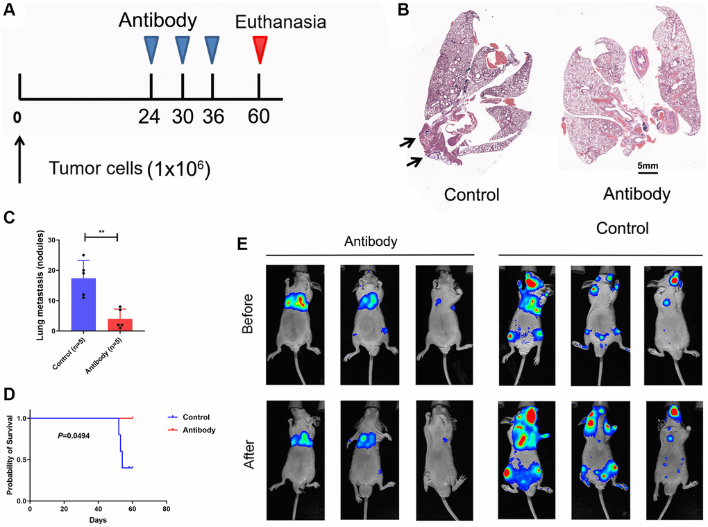 Blockade CTSV suppresses tumor metastases in lung cancer. (A–C) Lung metastasis nodules after tail vein injection of A549 cells (n = 3 mice per group). (D) Kaplan-Meier analysis of the indicated mice. (E) Intravenous injection of A549 cells for metastasis analysis. Representative images of antibody-treated mice and bioluminescent imaging (BLI) are shown (n = 3 mice per group). The representative data are repeated for three independent biological experiments. Student’s t-tests were used for data analysis; ****P-value 