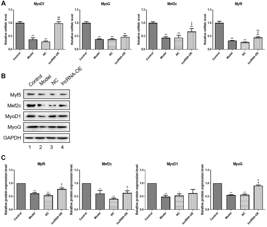 The effect of overexpression of GPRC5D-AS1 on muscle regulatory factors. (A) qRT-PCR analyzed gene expression of Myf5, MyoG, MyoD and Mef2c. HSMM was control group. Dex (15 mM) was added in HSMM to establish atrophy cell model (model group). Empty plasmid (NC group) and GPRC5D-AS1-OE plasmid (lncRNA-OE group) were transfected into atrophy cell model and incubated for 48 h. *P **P #P ##P &P &&P B) Protein expression of Myf5, MyoG, MyoD and Mef2c detected by Western blot. Groups were set as previously mentioned. Empty plasmid and GPRC5D-AS1-OE plasmid were transfected into atrophy cell model and incubated for 48 h. (C) Quantitative analysis of western blot. *P **P #P ##P &P &&P 