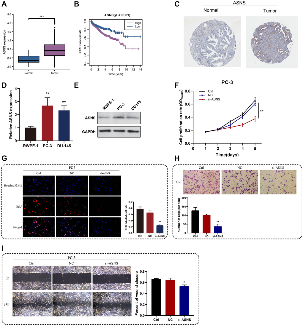 In vitro experiments for ASNS. (A) Relative expression of ASNS in PRAD and normal tissues in TCGA cohort. (B) ASNS was associated with worse BCRF survival of PRAD patients in TCGA cohort. (C) Human Protein Atlas revealed that ASNS protein expression was relatively higher in PRAD. (D, E) The expression levels of ASNS in PC-3 and DU145 cells were relatively higher than in RWPE-1 cells using qRT-PCR and western blot. (F) The CCK-8 assays demonstrated the correlations between ASNS and proliferation activity. (G) The EdU assays showed the correlations between ASNS and proliferation activity. (H) The transwell assays demonstrated the correlations between ASNS and migration capacity. (I) The invasion assays showed the correlations between ASNS and invasive competence. *p **p ***p 