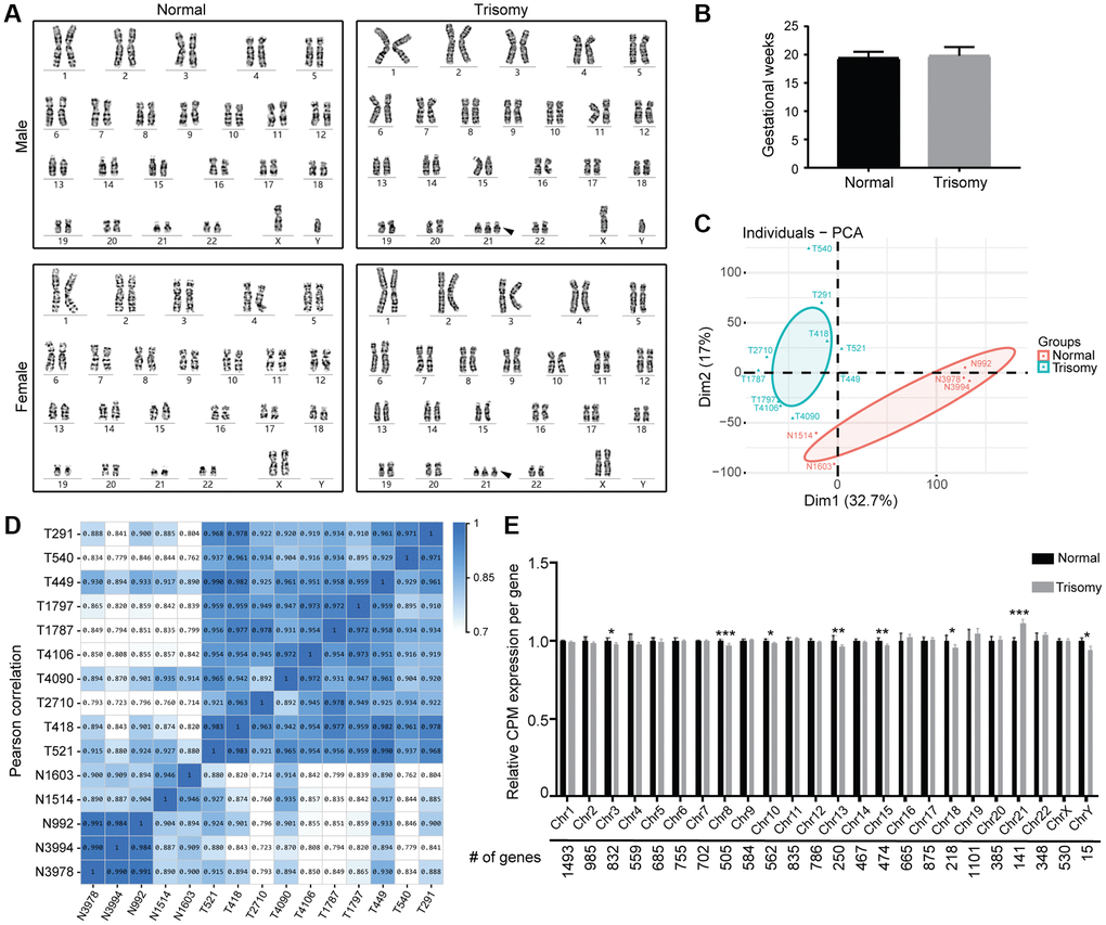 RNA sequencing of amniocytes derived from the normal and trisomy 21 groups. (A) Karyotyping results of cultured amniocytes from the trisomy 21 and normal groups, including males and females. Black arrow indicates the additional Chr21. (B) Gestational age of pregnant women in this study (nNormal = 5, nTrisomy = 10). (C) PCA plot comparing the normal and trisomy 21 groups according to their mRNA expression using counts per million (CPM) normalization. (D) Pearson correction heatmap of different samples in the normal and trisomy 21 groups. (E) Average mRNA expression per chromosome was calculated and quantified in the normal and trisomy 21 groups (*p **p ***p t test).