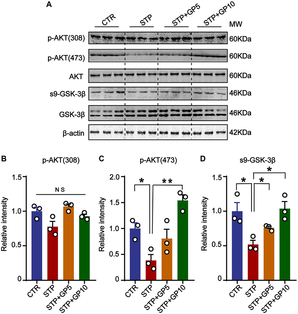 GP restored the activity of AKT/GSK-3β signaling axis. (A) Western blots for AKT/GSK-3β pathway-related proteins. (B–D) Quantification of the relative protein levels of p-AKT (308), p-AKT (473) and s9-GSK-3β after normalization to the β-actin signal. Data represent mean ± SEM, p-value significance is calculated from one-way ANOVA, n = 3. *P **P 