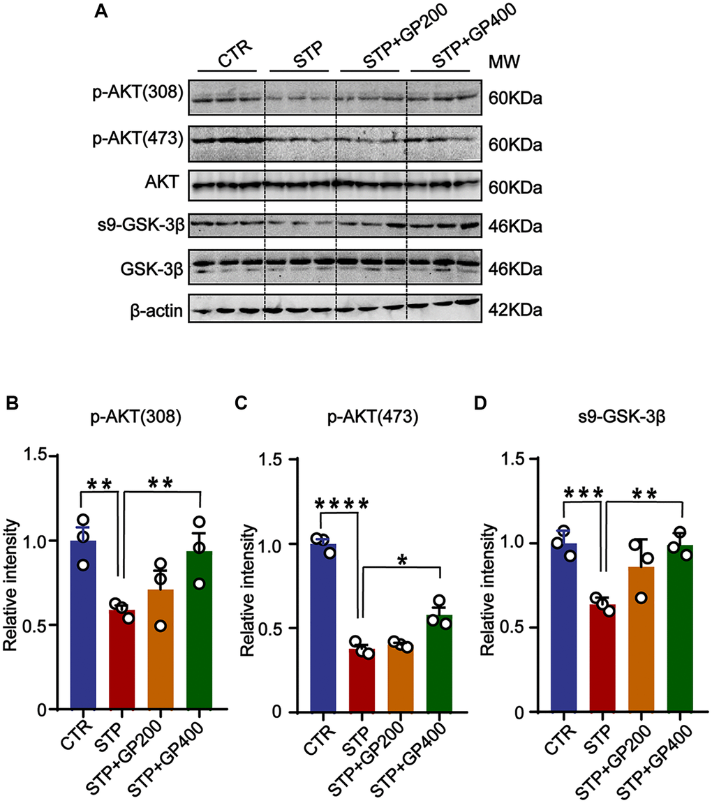 GP reactivates AKT/GSK-3β pathway in STP rats. (A) Western blots for AKT/GSK-3β pathway-related proteins. (B–D) Quantification of the relative protein levels (p-AKT (308), p-AKT (473), s9-GSK-3β) after normalization to the β-actin signal. Data represent mean ± SEM, p-value significance is calculated from one-way ANOVA, n = 3. *P **P ***P ****P 