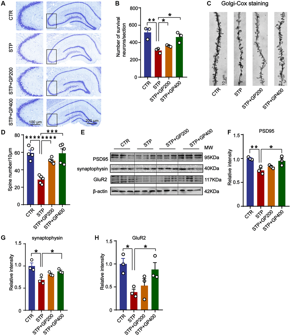 GP reverses dendritic spine loss and recovers postsynaptic proteins. (A, B) Representative Nissl staining images and the quantification of neuron number in the CA3 region of rat hippocampus, scale bar = 200 and 100 μm for low and high magnifications respectively. (C, D) Representative Golgi staining images and statistics analysis of spine number in the dentate gyrus region of rat hippocampus (scale bar, 10 μm). n = 5. (E–H) Western blots and quantitatively analysis for synaptic proteins (PSD95, GluR2 and synaptophysin) levels in rat hippocampus. Data represent mean ± SEM, p-value significance is calculated from one-way ANOVA, n = 3, *p **p ***P ****P 