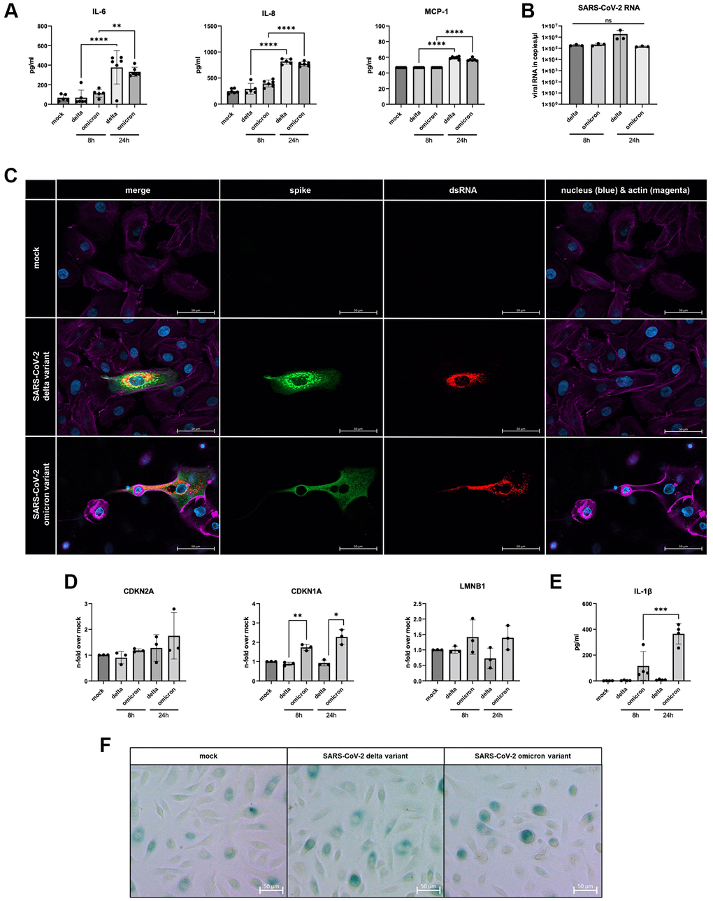 (A) Increased levels of IL-6, IL-8, and MCP-1 of infected supernatants of SAECs (n = 3) determined 8 h and 24 h p.i. compared to non-infected mock. (B) SAECs were infected with SARS-CoV-2 delta or omicron variant with an MOI of 5 for 24 h. Infected cells show clear signals for intracellular spike protein (green) and dsRNA (red). (C) SARS-CoV-2 RNA detected in cell lysates of infected SAECs after 8 h and 24 h p.i.. (D) Gene expression of senescence markers CDKN1A, CDKN2A, and LMNB1, normalized to mock cells. CDKN1A is significantly upregulated in cells infected with omicron variant compared to the delta variant. (E) Levels of the senescence-associated secretory phenotype (SASP) protein IL-1β are significantly increasing in omicron-infected cells from 8 h to 24 h p.i.. (F) β-Galactosidase staining of SAECs after 24 h p.i. with SARS-CoV-2. Scalebar indicates 100 μm. P calculated by one-way ANOVA with Tukey’s multiple comparisons tests (A, E) and Welch’s t-test (D), *p **p ***p ****p 