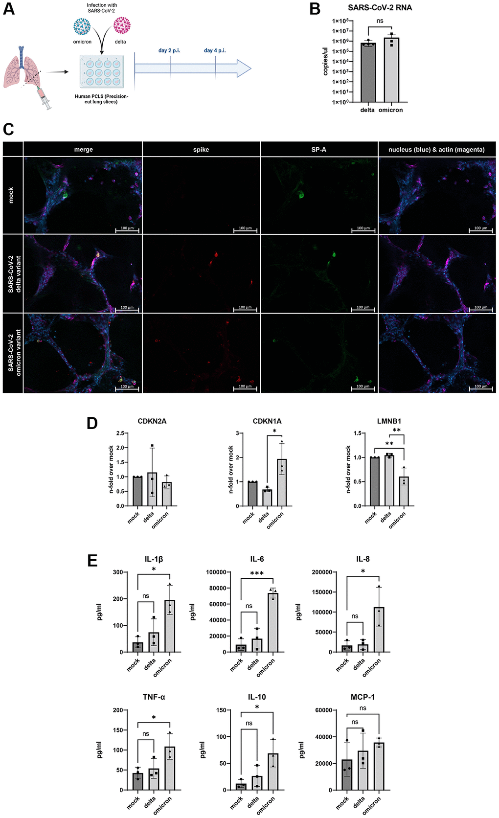 (A) Schematic overview of the experimental setup for the infection of human PCLSs with SARS-CoV-2 delta and omicron variant. Created with https://www.biorender.com/. (B) SARS-CoV-2 RNA detected in supernatants of infected human PCLSs after 2 d p.i.. (C) Immunofluorescent staining of mock and infected PCLS. Surfactant protein a (SP-A, green) positive cells are visible in the alveoli of mock and infected slices 4 d p.i.. Colocalization of spike protein (red) and SP-A positive cells in the alveolus of infected slices. Scalebar indicates 100 μm. (D) Gene expression of senescence markers CDKN1A, CDKN2A, and LMNB1, normalized to mock PCLSs. CDKN1A is significantly upregulated in cells infected with omicron variant compared to delta. LMNB1 expression is significantly downregulated in omicron slices compared to delta and mock (E) Levels of the senescence-associated secretory phenotype (SASP) proteins IL-1β, IL-6, IL-8, TNF-α, IL-10 are significantly upregulated in omicron- and delta-infected PCLSs at 2 d p.i. MCP-1 levels are on average highest in omicron-infected slices. P calculated by one-way ANOVA with Multiple comparisons (D, E), *p **p ***p 