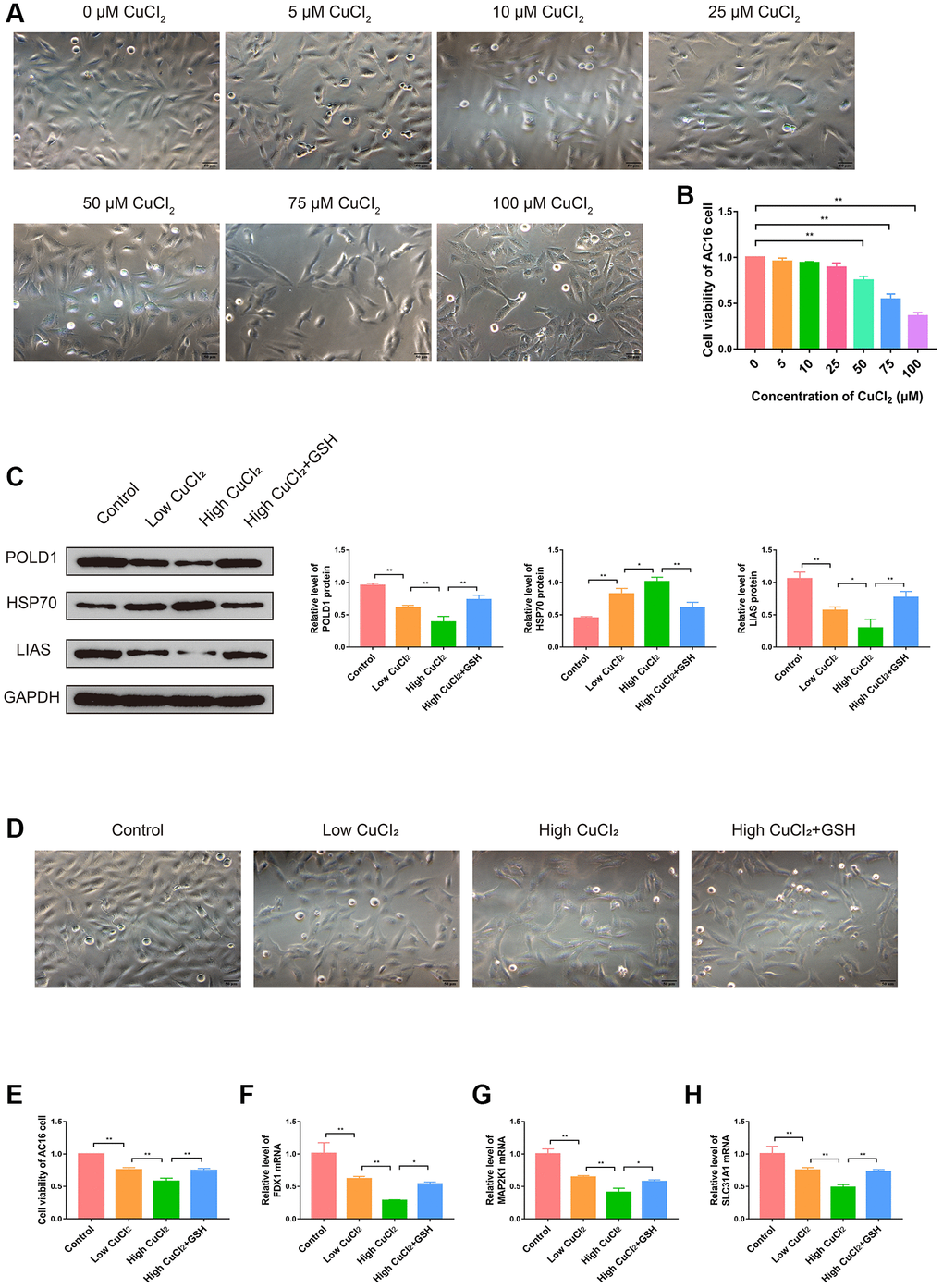 Effects of CuCl2 on morphology, viability and cuproptosis degree of AC16 cells. (A) The effects of CuCl2 on AC16 cells morphology. (B) The effects of CuCl2 on AC16 cells viability. (C) The protein expression levels of POLD1, HSP70 and LIAS in AC16 cells (n = 3). (D) The effects of GSH on AC16 cells morphology. (E) The effects of GSH on AC16 cells viability. (F–H) The mRNA expression levels of three K-CRGs in AC16 cells. (*P **P 