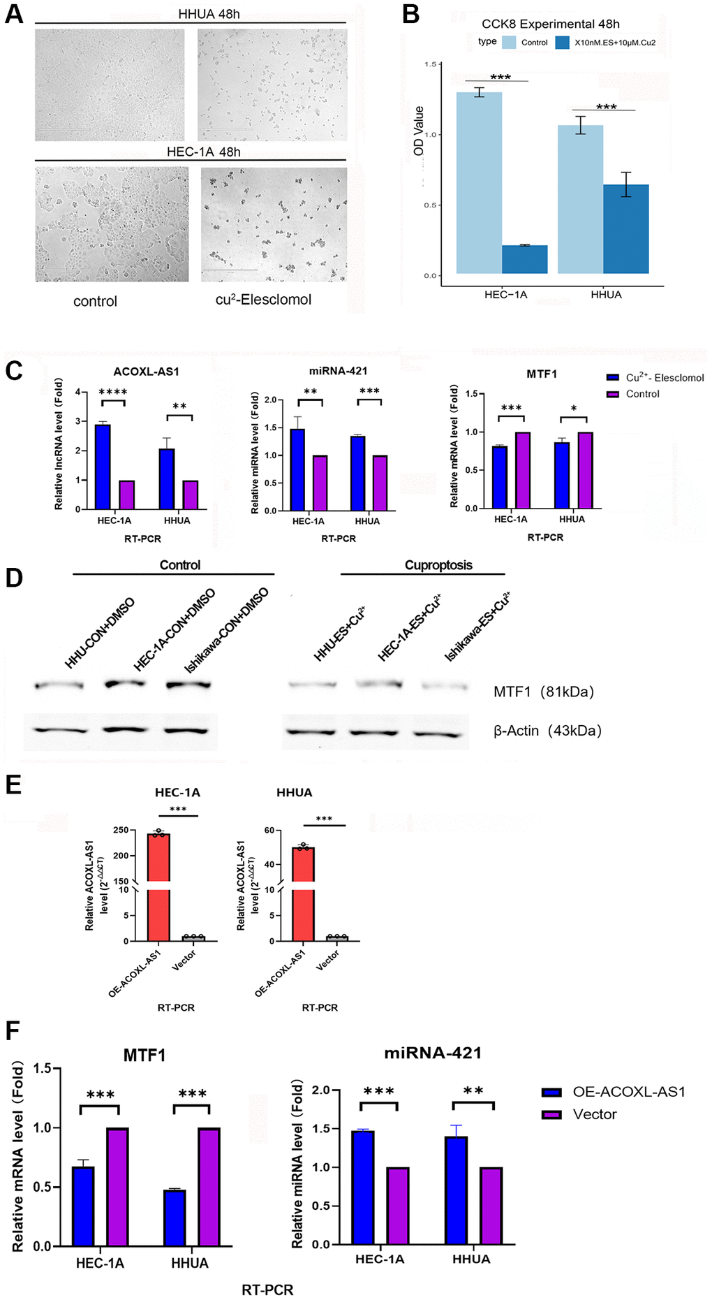 Cuprotosis cell model and expression of ACOXL-AS1, mir-421 and MTF1 in endometrial cancer cells. (A) Colony formation ability under differential conditions as determined by a colony formation assay. (B) Proliferation of endometrial cancer cells is detected by the Cell Counting Kit-8 assay. (C, D) Relative expression of ACOXL-AS1, mir-421 and MTF1 in endometrial cancer cells under different conditions. (E) overexpress the ACOXL-AS1 gene in HEC-1A and HHUA cells, while the “negative control lentiviral vector” is used as a reference (F) The impact of ACOXL-AS1 overexpression on the expression levels of MTF1 and miR-421, **p ***p ****p 