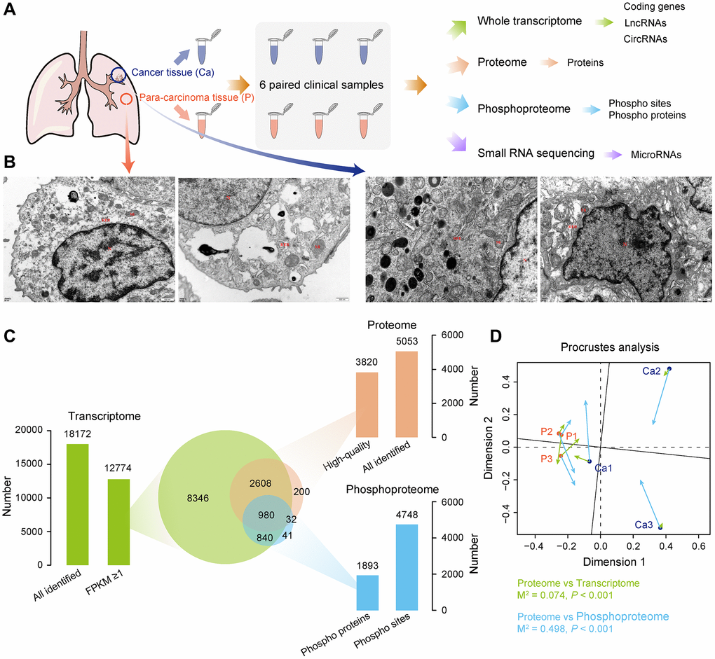 Multi-omics landscape of LUAD samples. (A) Experimental workflow to analyze transcriptome, proteome, phosphoproteome, and small RNA sequencing data. (B) Electron micrograph of the tissue section. Left, non-tumor tissue; right, LUAD tissue. (C) Quantitative statistics of total genes among transcriptome, proteome, and phosphoproteome, as well as the overlap of gene number among three omics. (D) Procrustes analysis shows the correlation between different omics.