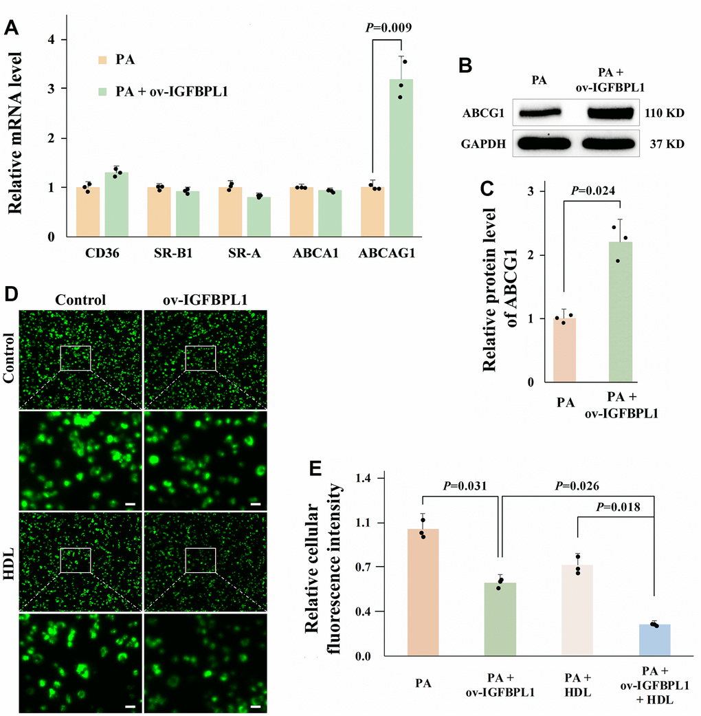 IGFBPL1 increases macrophage cholesterol efflux through ABCG1. (A) Relative mRNA level of genes relative to cholesterol uptake and efflux (n=3). (B) WB was used to detect the protein level of ABCG1. (C) Quantitative statistics on WB results by ImageJ (n=3). (D) Representative images of NBD cholesterol fluorescence staining of macrophages. (E) Quantitative results of average fluorescence intensity of per THP-1 macrophage cell (n=3). PA: palmitic acid, THP-1 macrophages were incubated with 100 μM PA for 48 h. PA + ov-IGFBPL1, THP-1 was transfected with over-expression plasmid of IGFBPL1 for 24 h and then incubated with 100 μM PA for 48 h. P