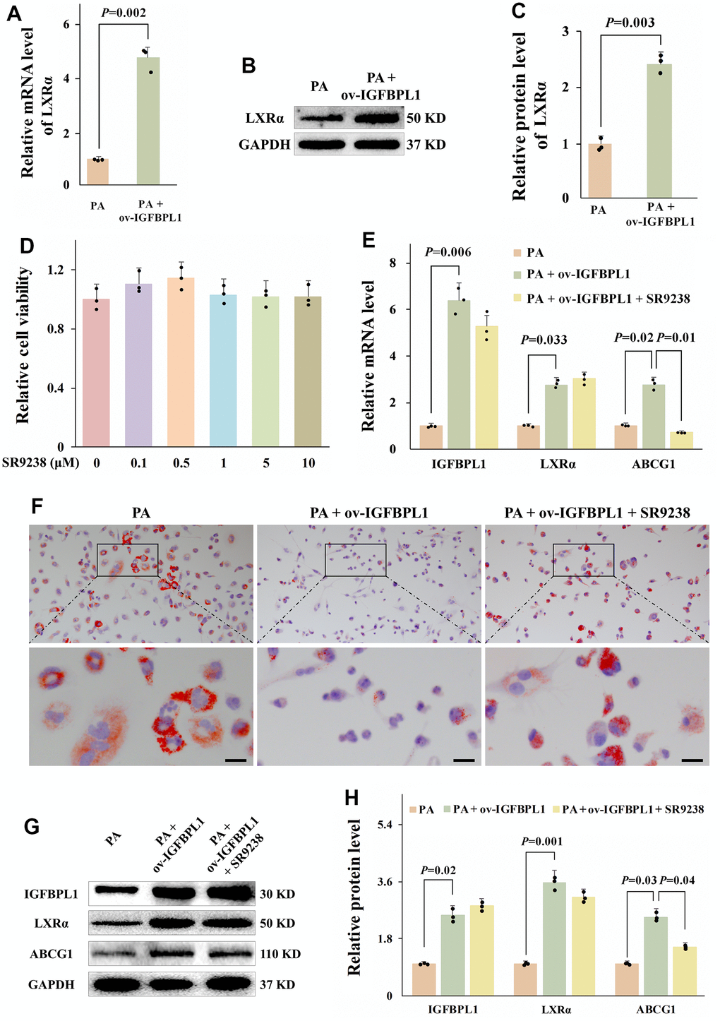 LXR meditated the regulation effect of IGFBPL1 on ABCG1 expression and macrophage lipid accumulation. (A) Relative mRNA level of LXR (n=3). (B) WB was used to detect the protein level of LXR. (C) Quantitative statistics on WB results by ImageJ (n=3). (D) CCK-8 was used to detect the cell viability (n=3). (E) Relative mRNA level of IGFBPL1, IGBPL1, LXR and ABCG1 (n=3). (F) Representative images of oil red O staining. (G) WB was used to detect the protein level of IGFBPL1, LXR and ABCG1. (H) Quantitative statistics on WB results by ImageJ (n=3). PA: palmitic acid, SR9238: LXRα antagonist. PA + ov-IGFBPL1 + SR9238, T THP-1 was transfected for 24 h and then incubated with PA (100 μM) and SR9238 (1 μM) for 48 h. P