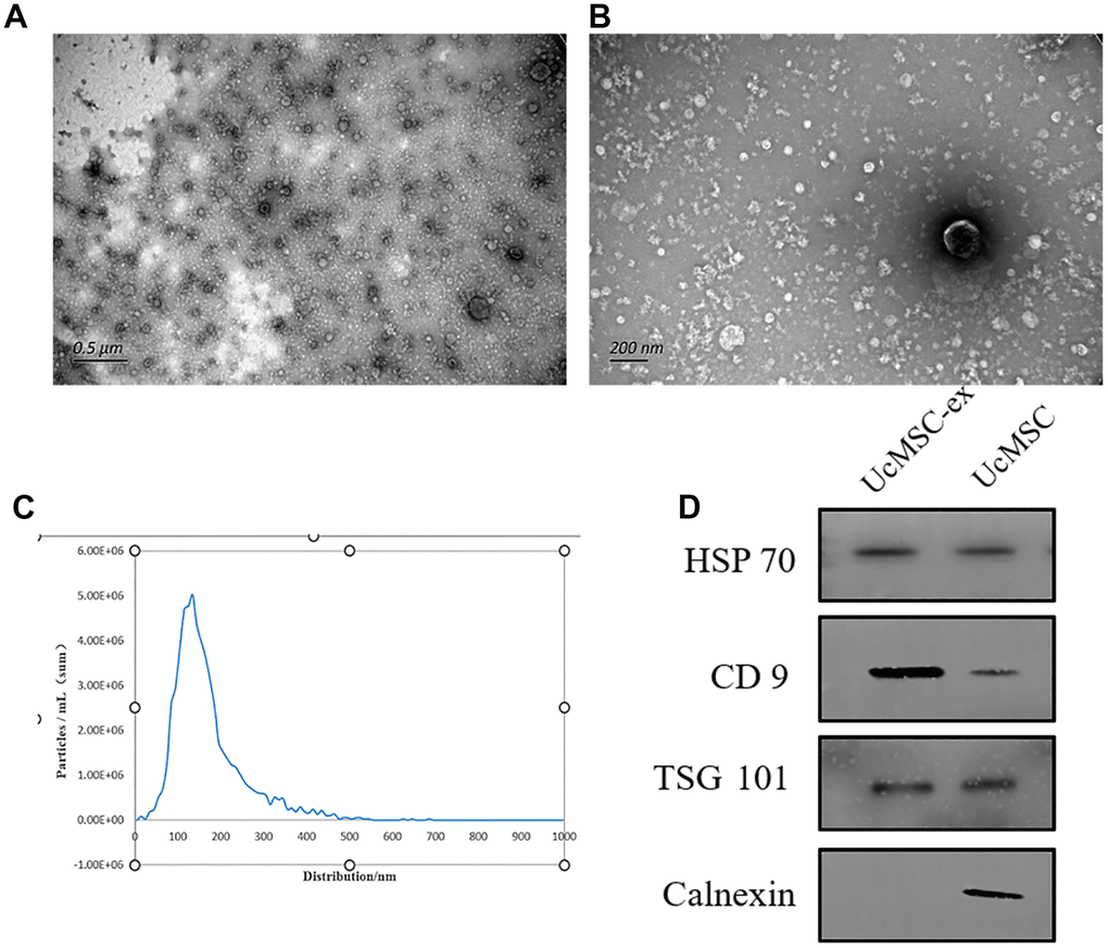 Characterization of umbilical cord mesenchymal stem cell-derived exosomes. (A, B) Representative transmission electron microscopy images of exosomes. (C) Nanoparticle tracking analysis showing the size distribution of exosomes. (D) Western blot analysis for the detection of specific proteins in ucMSC-ex.