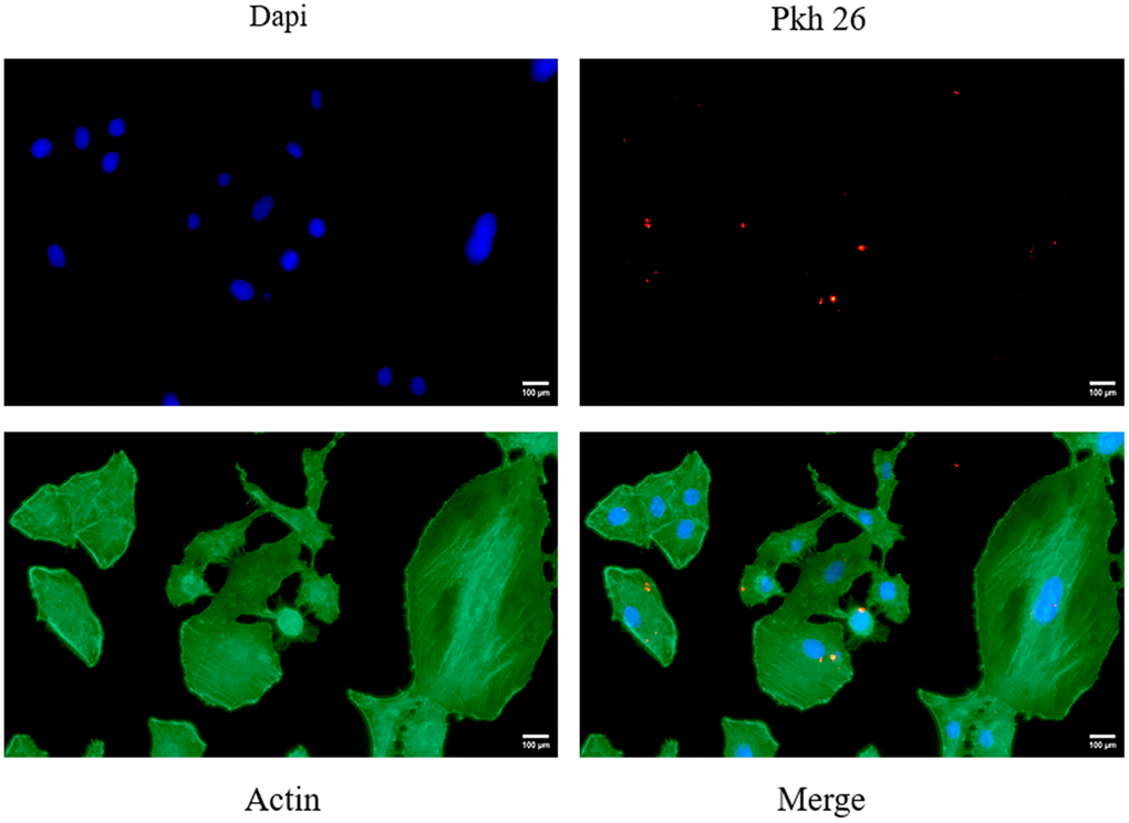 Shows the fluorescent images of VK2 cells taking up ucMSC-ex.