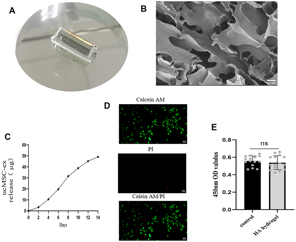 Characterization of exosome hydrogel. (A) Morphology of hyaluronic acid hydrogel post photopolymerization; (B) Cross-sectional view of hyaluronic acid hydrogel presenting a loose, porous structure under scanning electron microscopy; (C) Release curve of exosomes from the exosome hydrogel over 14 days; (D) Live/dead cell staining of VK2 cells cultured on the hyaluronic acid hydrogel. (E) Determination of cell viability by co-incubation of vk2 cells and hydrogels.